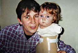 Lahir Tanpa Tangan dan Kaki, Joanne Tak Pernah Kecil Hati