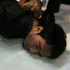 Alami Gangguan Jiwa, Adil Penusuk Kru tvOne Perlu Direhabilitasi