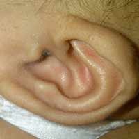 Bayi Berdaun Telinga Menyerupai Lafadz Allah