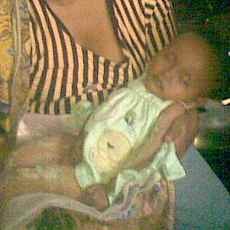 Osteoporosis, Tangan dan Kaki Balita 23 Bulan Bengkok dan Patah