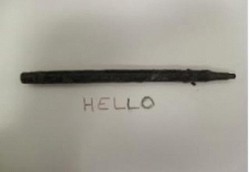 Nenek Telan Pulpen Selama 25 Tahun dan Pulpen Masih Berfungsi