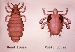 Kutu Kelamin Paling Doyan Hinggap di Kemaluan Remaja 