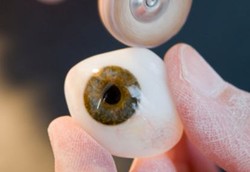 Dokter Temukan Bola Mata di Kemaluan Pasien Perempuan