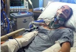 Sudah Siap Jadi Donor Organ Ternyata Tak Jadi Meninggal