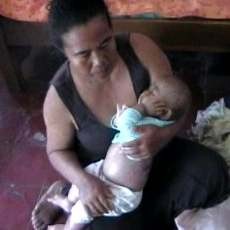 Meninggal, Balita Penderita Dermatitis Dibawa Pulang Naik Motor