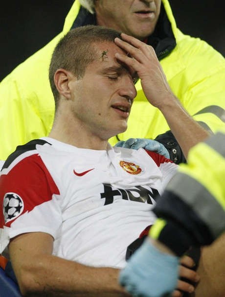 Operasi Vidic Sukses, Fergie Sabar Menunggu 