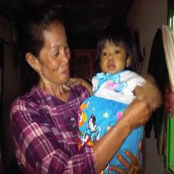 Kisah Balita Karin, Melawan Pembengkakan Hati Sejak Usia 6 Bulan