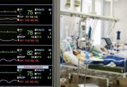 Perawatan Pasien yang Kurang Tepat Sering Terjadi di ICU