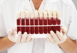 Darah Haid Bisa Disimpan di Bank Darah untuk Stem Cell