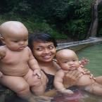 Kembar Zahra dan Zahwa, 10 Bulan; Perempuan; f