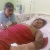 Pengakuan Sulung yang Dianiaya Aparat Pengamanan SBY Dimentahkan Polisi