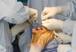 Tak Perlu Operasi Lutut ke Luar Negeri, Dokter RI Juga Ahli