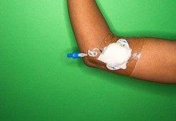 Main Suntik Obat Terlarang, Akhirnya Lengan Melayang