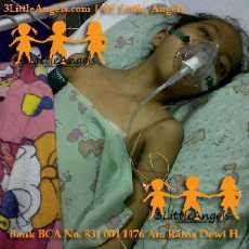 Tolong! Auliya Penderita Pendarahan Usus & Gizi Buruk Butuh Bantuan