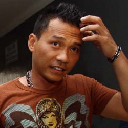 Kelelahan, Anang Hermansyah Dilarikan ke Rumah Sakit