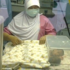 Bayi Kembar Siam Wanda Wandi tak Kunjung Dioperasi