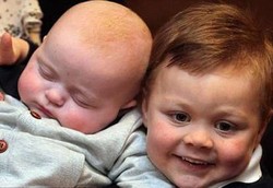 Sembuh dari Kanker Darah Berkat Tali Pusar sang Adik