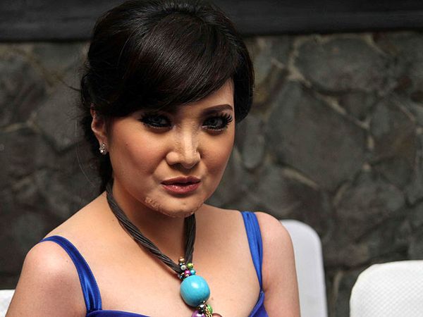 Ada Apa dengan Wajah Kiki Amalia?