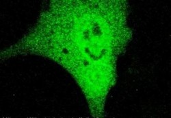 Ada Sel Kanker yang Tersenyum Saat di Bawah Mikroskop