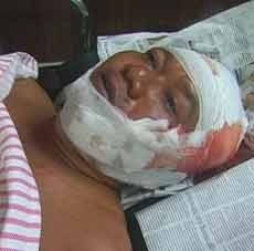 Satu Penumpang Korban Kecelakaan di By Pass Krian Gagal ke Malaysia