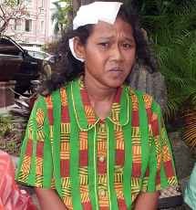 Gagal Diperkosa, Penderita Lemah Mental Dapat 17 Jahitan