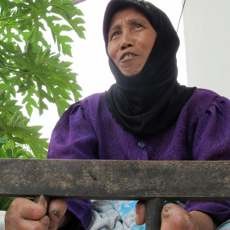 Hari Kusta Sedunia, Kenapa Masyarakat Masih Sinis?