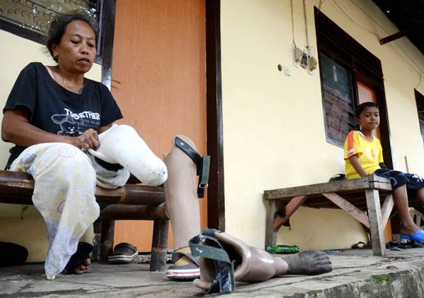 Melongok Ponsos Kusta Babat Jerawat