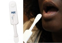 Tak Perlu Pakai Darah, Tes HIV Kini Bisa Lewat Gusi