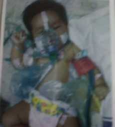 BAB Lewat Anus & Vagina, Bayi Faiyasa Butuh Bantuan