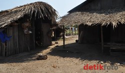 Tolong! Selama 8 Tahun, Anak Ini Buang Air Besar Lewat Perut