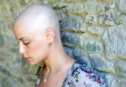 10 Kanker yang Paling Mematikan dan Sulit Disembuhkan