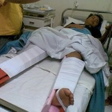 Bobotoh yang Patah Kaki Ngebet Bertemu Airlangga