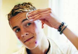 Keratosis Pilaris, Benjolan Seperti Jerawat Kasar