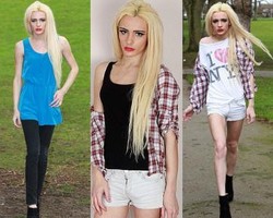 Terinspirasi Lady Gaga, Pria Ini Akan Ganti Kelamin