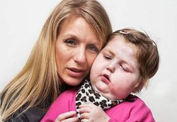 Anak Kena Kanker Karena Ibu Menyusui dengan Payudara Silikon