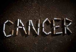 5 Jenis Kanker yang Paling Banyak Membunuh Pria & Wanita