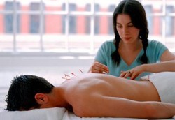 Akupunktur Bisa Bantu Tingkatkan Kesuburan Pria dan Wanita