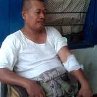 Sejumlah Desa di Sidoarjo Diteror Kera, 23 Orang Diserang dan Digigit