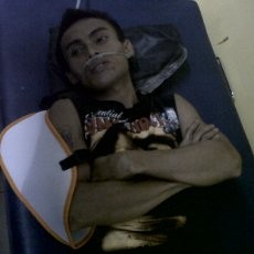 Korban Tabrakan Bus Maut: Saya Lagi Tidur, Tiba-tiba Duaarrr...