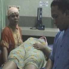 Ibu Hamil 2 Bulan Jadi Korban Gigitan Kera