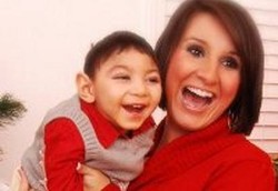 Microcephalus, Kepala Lebih Kecil Dari Ukuran Normal 