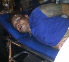 20 Brimob Bersenjata Lengkap Jaga John Kei di RS Polri 