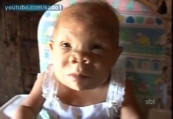  Wanita 30 Tahun dengan Tingkah dan Tubuh Seperti Bayi 9 Bulan