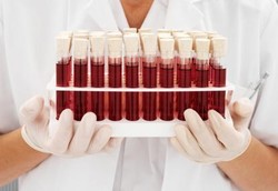 Memangkas Lemak di Darah Bisa dengan Cara Ini