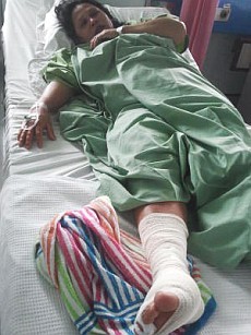 Mandi di Sungai, Ibu Rumah Tangga Nyaris Tewas Diserang Buaya