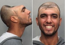 Kepala Tinggal Separuh Seperti Alien Akibat Hobi Pakai Narkoba