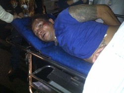 Ditembak di Tulang Kering, John Kei Masih Jalani Pemulihan