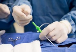 Utak-atik Jantung Pakai Kawat, Sembuhnya Jauh Lebih Cepat