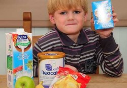 Cuma Bisa Makan 9 Jenis Makanan Karena Alergi Langka