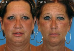 Beginilah Potret Wajah Para Perokok